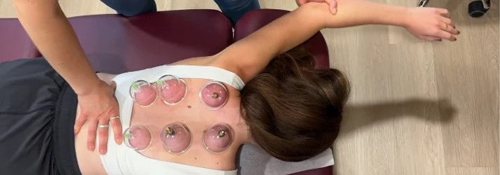 Female patient receiving cupping treatment, lying on a chiropractic bed